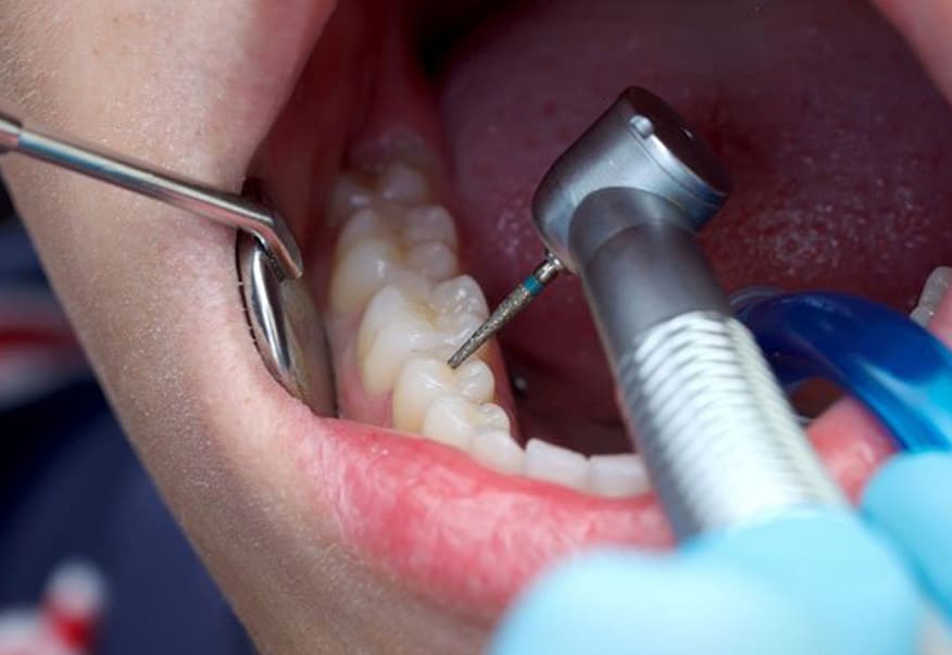 Luck patient undergoing root canal treatment